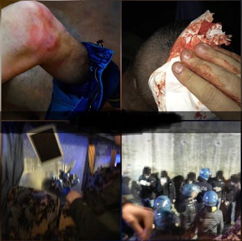 Le manganellate dei poliziotti ai tifosi atalantini di ritorno da Firenze. Si muove la politica per fare la massima chiarezza su una brutta vicenda